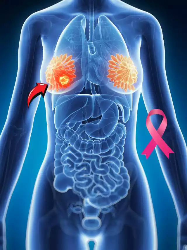 cancer